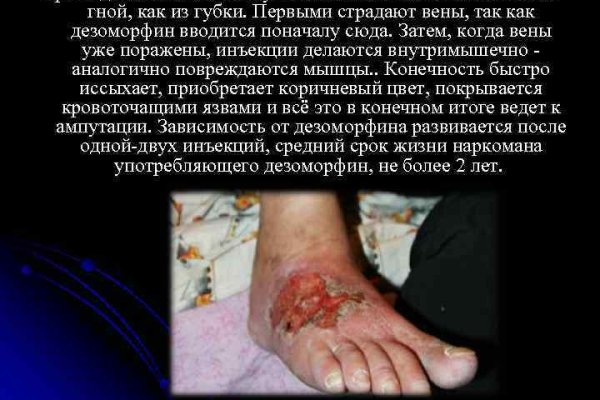 Почему не получается зайти на кракен