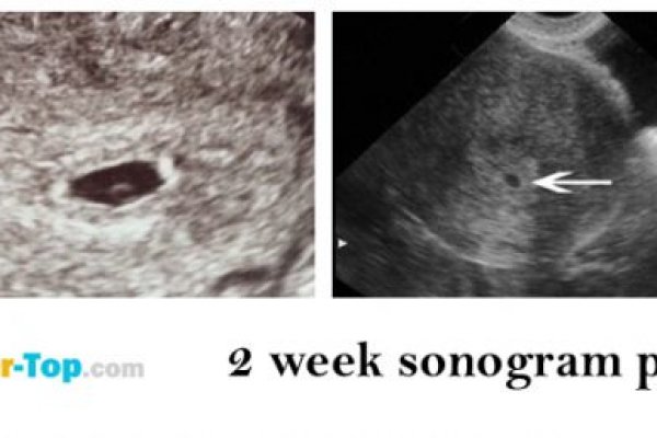 Кракен телеграмм магазин