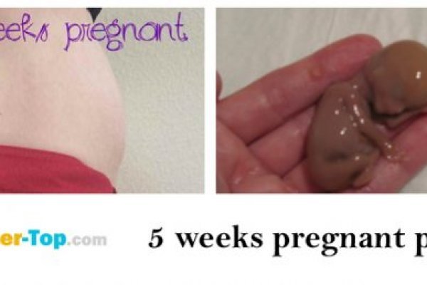 Что продают на сайте кракен