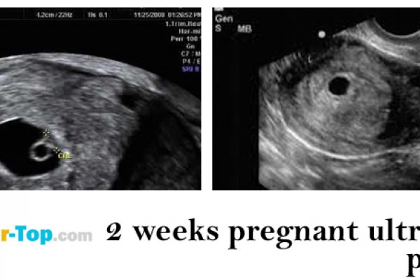 Кракен маркетплейс что там продают